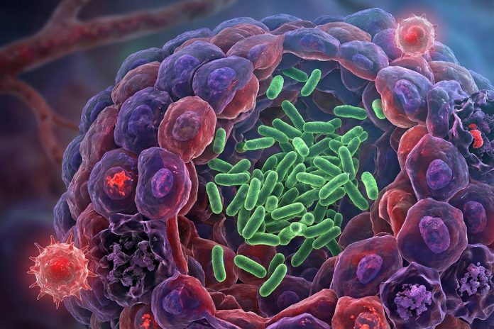 Cancer-Fighting Probiotics